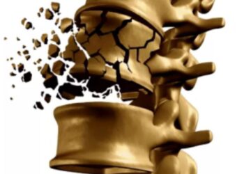 Osteoporoza și exerciții fizice recomandate