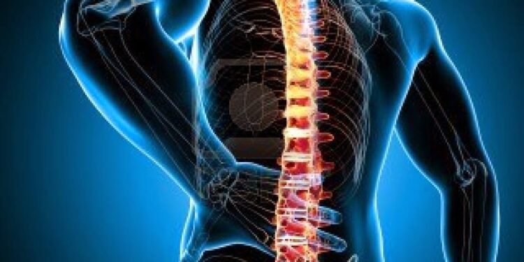 Spondilita anchilozantă