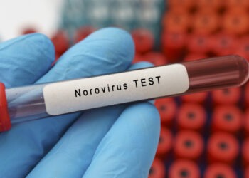 Informații utile legate de focarul epidemic de infecție cu Norovirus de la Liceul CD Loga din Timișoara