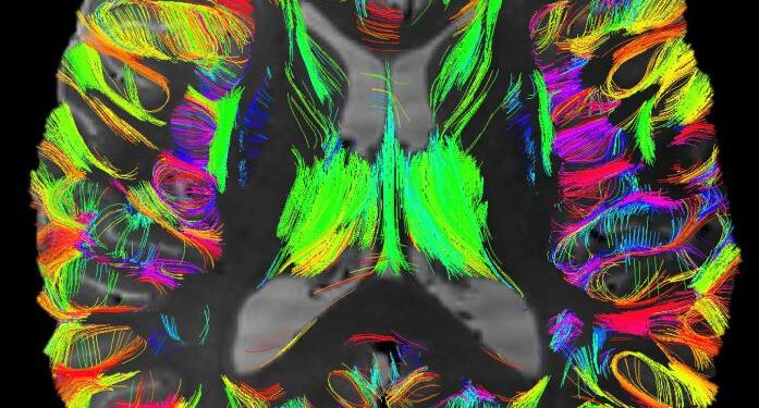 Cartografierea creierului