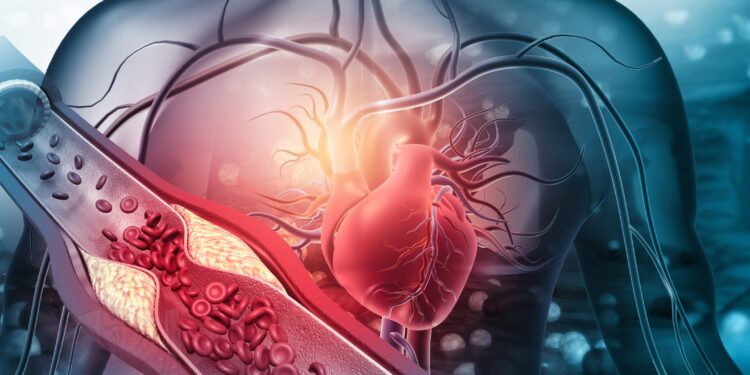 Două studii noi arată beneficiile dietei Portfolio asupra bolilor cardiovasculare (CVD)