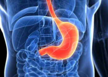 Cum să gestionezi gastropareza