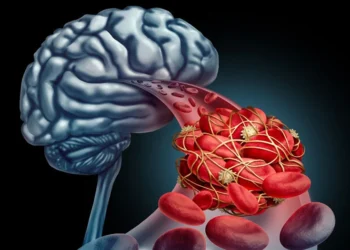 Pericolul tăcut al malformațiilor venoase cerebrale