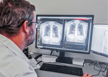 Inteligența Artificială intră în radiologia timișoreană